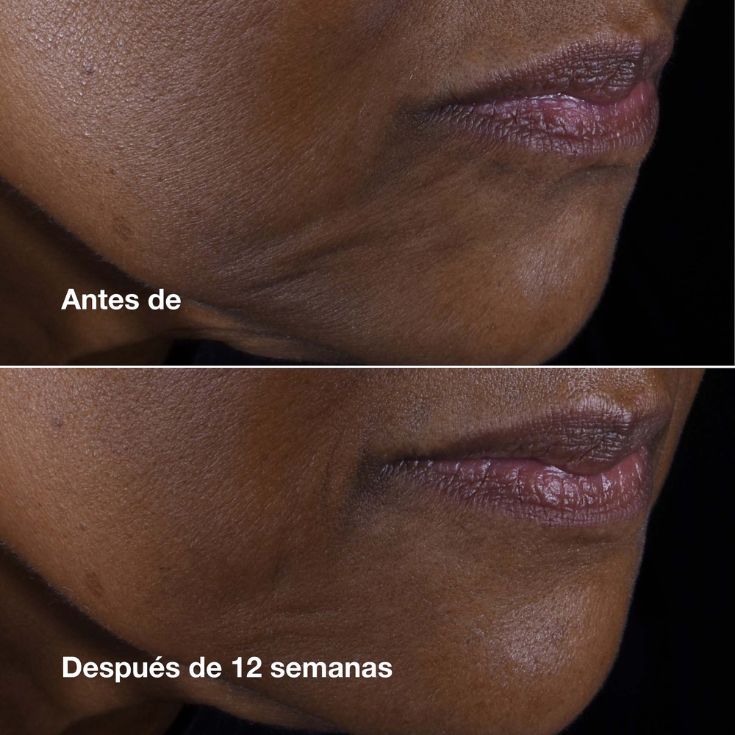 CREMA HUMECTANTE SMART CLINICAL REPAIR™  LIFT ROSTRO Y CUELLO ANTIEDAD